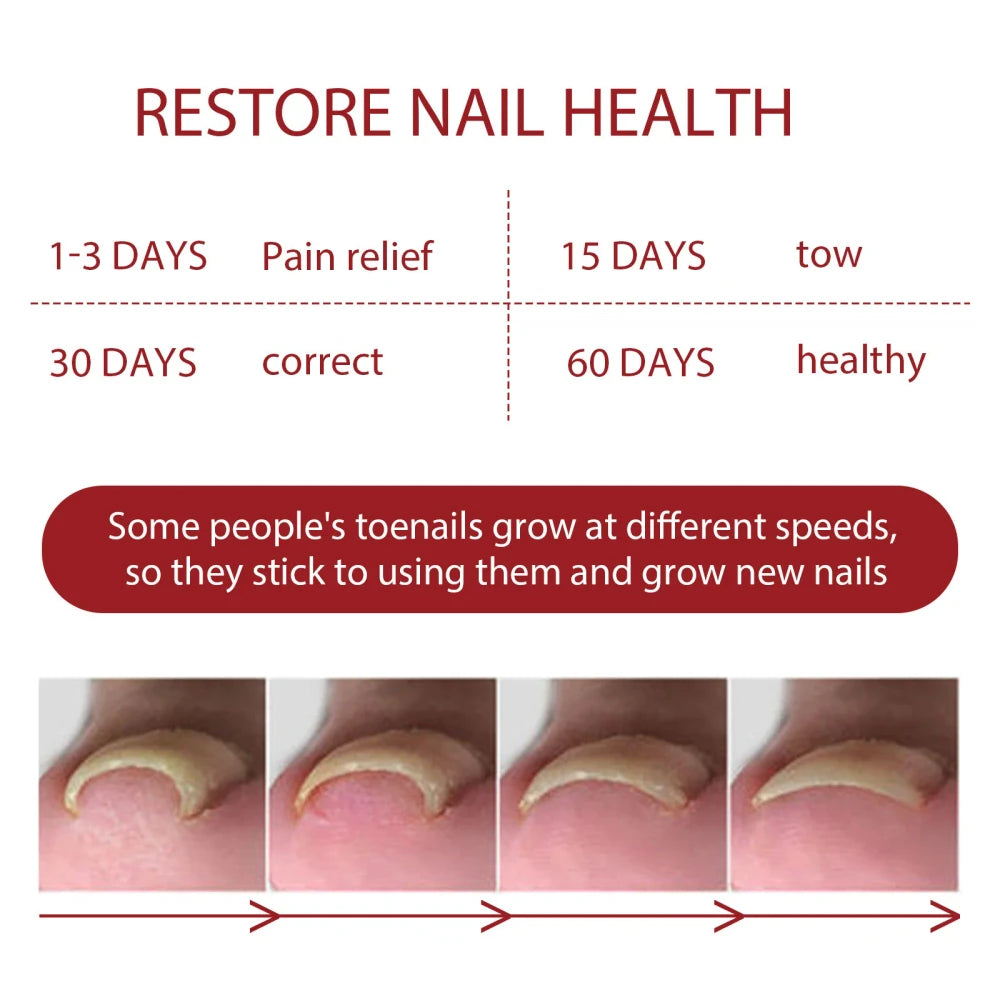 Aceite anti hongos german toenailpuls 10ml