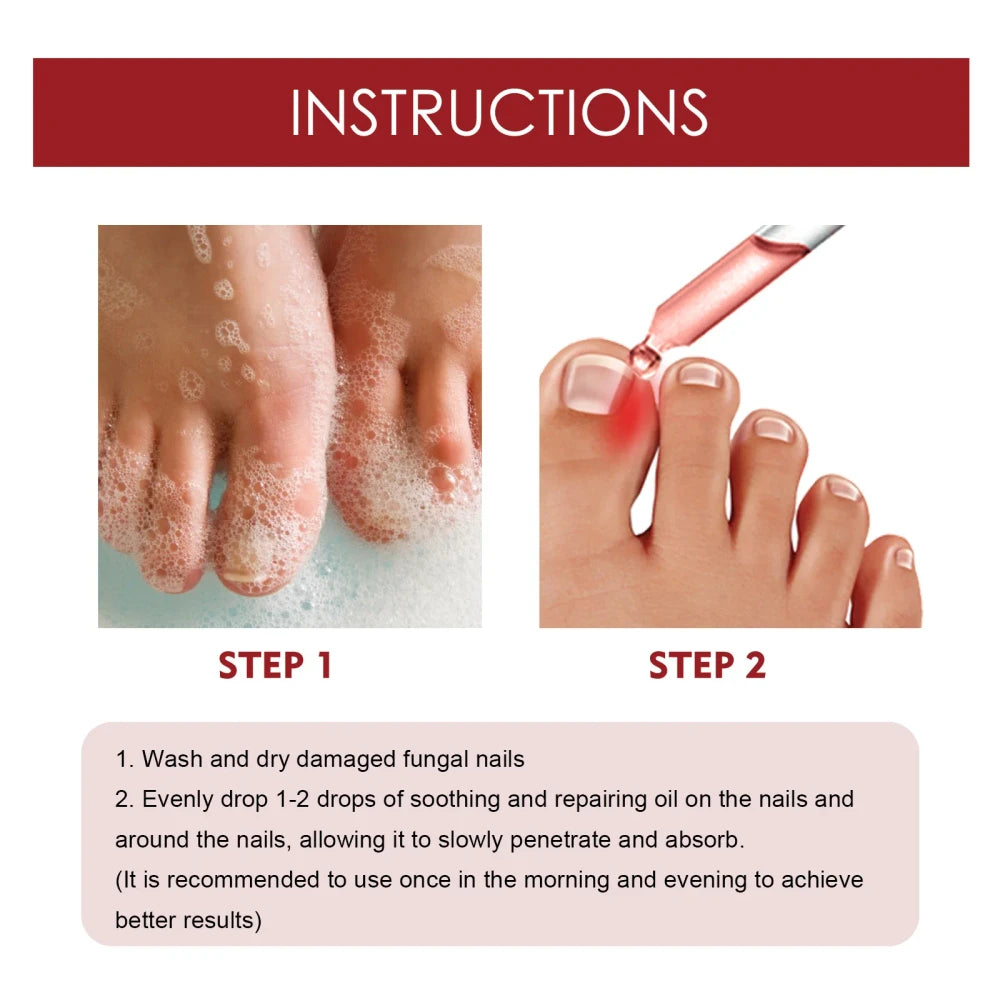 Aceite anti hongos german toenailpuls 10ml